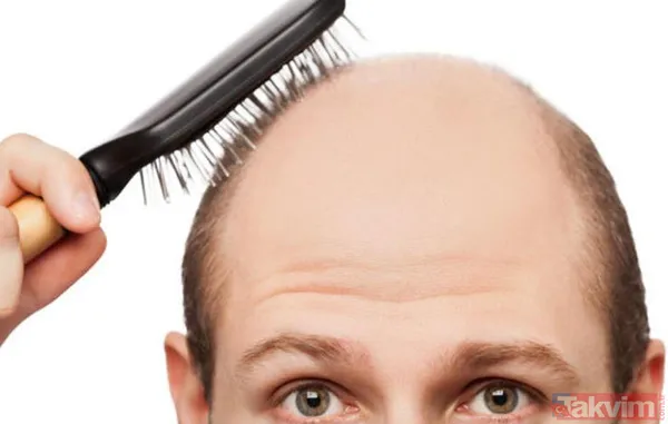 Kelliğin merhemi bulundu 40 yıl düşünsek aklımıza gelmez! Saçı olmayanlar bu haber sizin için müjde ki ne müjde - 5