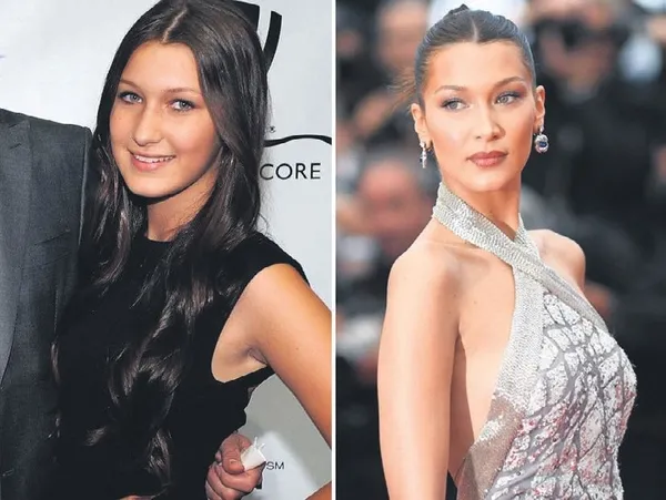 Online toplantılar hayatımıza girdi: Ekranda kendilerini beğenmeyenler estetik merkezine akın etti-2