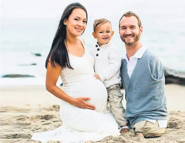 Nick Vujicic kolları ve bacakları olmadan dünyaya geldi hayata küsmedi:-9