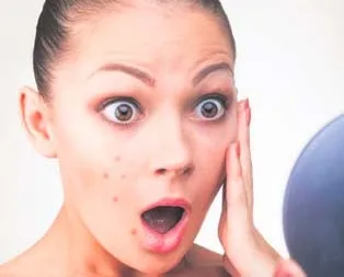 Sivilce hastalığı bilmece