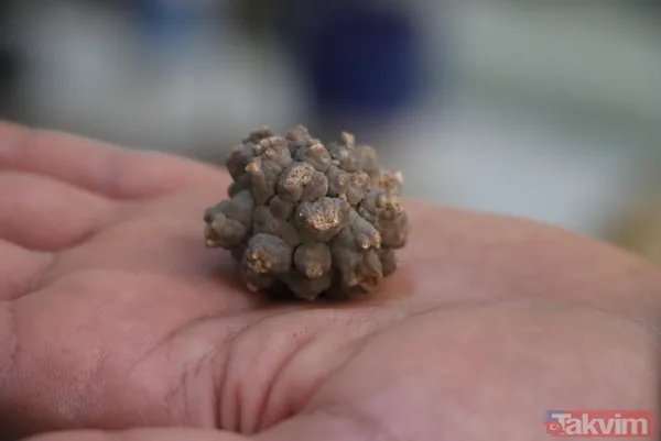 Üroloji doktorundan hayrete düşüren koleksiyon! Taşların kimisi 22 santim kimisi 650 gram - 9