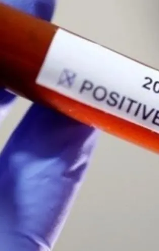 İşte corona virüsün görülmediği 10 ülke!