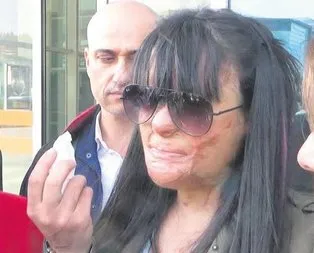 Berfin Özek davasında savcı Öldürme kastı yok deyip saldırgan için 1 yıl hapis istemiyle mütalaa hazırladı