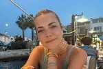 Beyin ameliyatı geçirmişti! Burcu Kara 