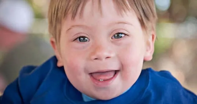 eroin kuzeydogu hakiki ruyada down sendromlu erkek cocugu gormek floridafamilyvilla highgatepark com