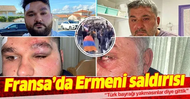 Fransa’da Ermenilerin saldırdığı Türk genç: Türk bayrağı yakmasınlar diye gittik