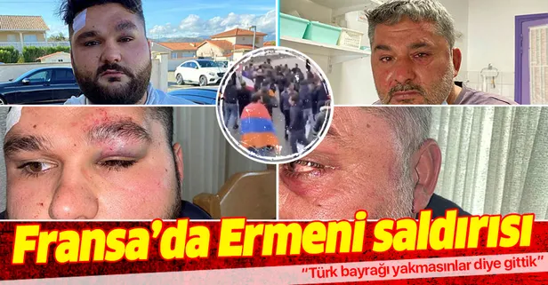 Fransa’da Ermenilerin saldırdığı Türk genç: Türk bayrağı yakmasınlar diye gittik