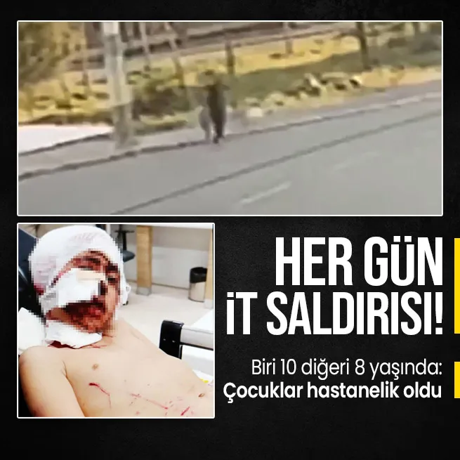 Peş peşe sokak köpeği saldırıları! İzmir ve Erzurumdan şok görüntüler