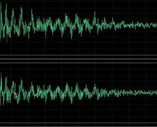 Ses dalgalarıyla beyni kontrol ettiler