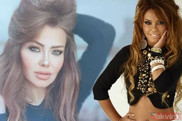 Şarkıcı Lara sonunda küçülttü! Estetikle bambaşka biri olan Lara paylaştı görenler 'yok artık' dedi - 1