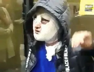 Korkunç olay! Eski sözlüsüne önce tecavüz etti sonra yüzüne kızgın yağ döktü!