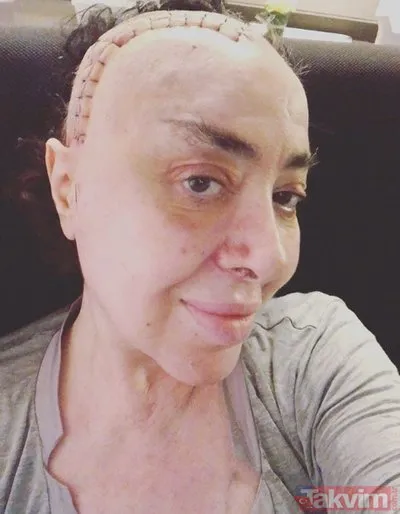 Nur Yerlitas In Son Halini Gorenler Sok Oldu 1 Yil Once Ameliyat Olan Nur Yerlitas In Hastaligi Neydi Galeri Takvim Nur Yerlitas In Son Halini Gorenler Sok Oldu 1 Yil Once Ameliyat Olan Nur Yerlitas In Hastaligi Neydi Galeri Takvim