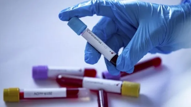 Çin'in koronavirüsle ilgili gizli belgeleri sızdı! Belgeleri yayınlayan doktorlar gözaltında!-1