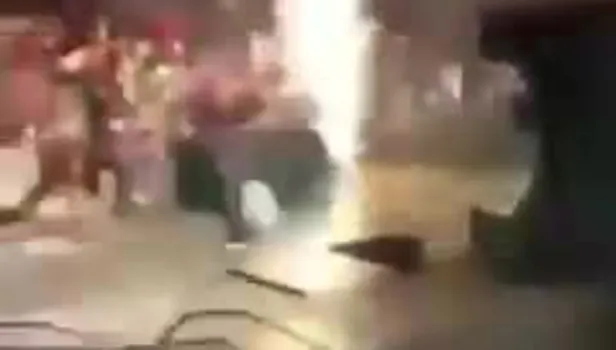 Murat Dalkılıç sahne kazası mı geçirdi?