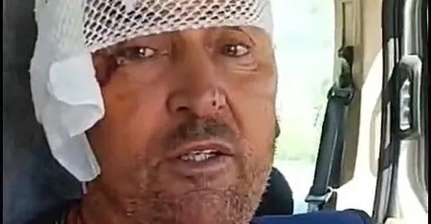 Antalya'da aslan dehşeti: Tarlada uyurken saldırdı, kulağını kopardı