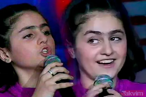 Aleyna Tilki’nin şiş dudakları olay oldu! Son halini gören dönüp bir daha baktı “Ajda Pekkan olma yolunda” - 9