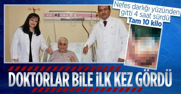 3 yıldır karın ve bel ağrısı şikayeti çeken yaşlı kadın nefes darlığı şikayetiyle hastaneye gitti karnından 10 kiloluk tümör çıkarıldı