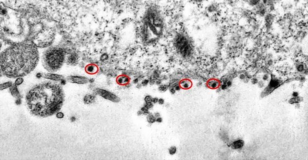 Son dakika: İşte koronavirüsün insan hücrelerine saldırdığı o an!-1