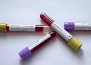 Koronavirüste son durum: 1.491 yeni vaka var