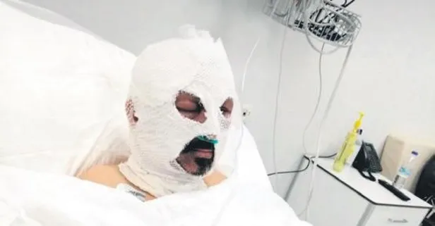 Yer: Zonguldak... Servis şoförünün üzerine tiner döküp yaktı!