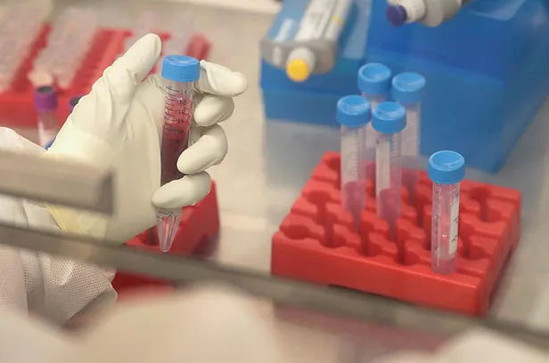 Bilim insanları ilk kez açıkladı: İngiltere'de negatif çıkan koronavirüs testlerinin yüzde 30'u...-5