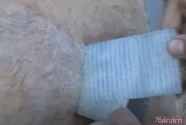 Karnındaki şişlik için gitti içinden çıkan doktorları bile şoke etti! Yer uzak değil Kayseri! 64 kilo girdi 55 kilo çıktı - 14