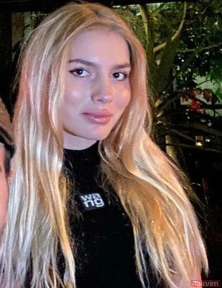 Aleyna Tilki’nin yüzü neden şişti? Annesine göre estetik değil 20 yaş