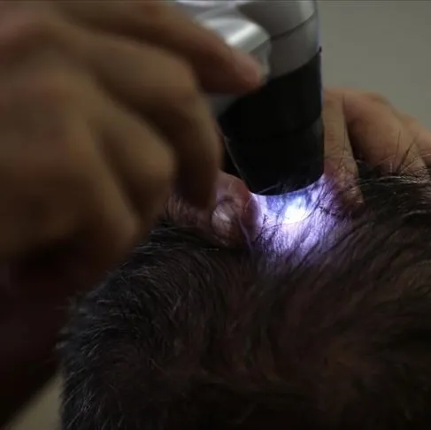 Kelliğe karşı devrim