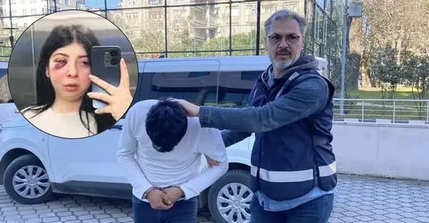 Sokak ortasında dehşeti yaşadı: Genç kadın darp sonrası yüzünün fotoğrafını paylaştı!
