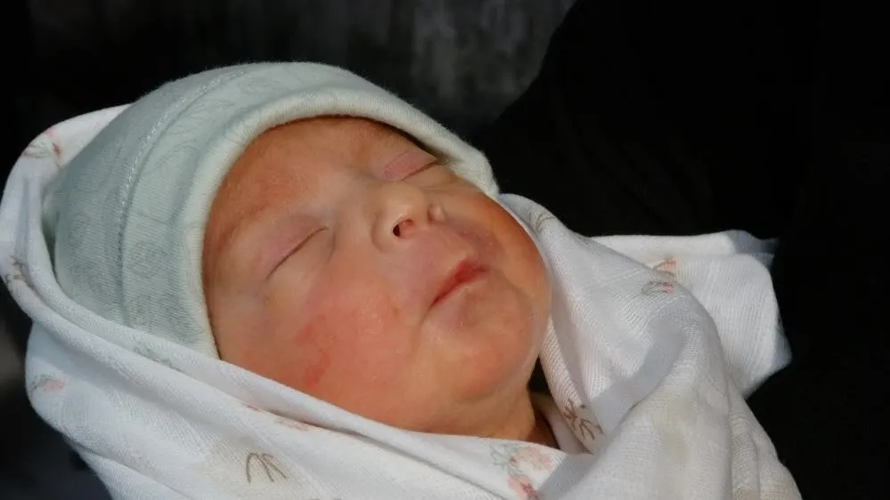 milyonda-bir-gorulen-dogum-trabzonda-iki-ayri-rahimde-olusan-bebekler-dunyaya-geldi-1786792296483.jpeg Milyonda bir görülen doğum Trabzon'da! İki ayrı rahimde oluşan bebekler dünyaya geldi-3