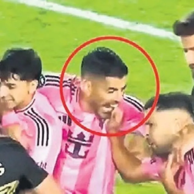 Suarez bu kez Alba’yı ısırdı