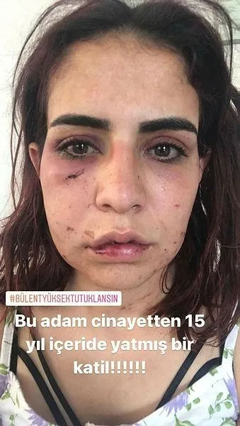 Son dakika: Antalya Alanya'da yürek yakan 'ölmek istemiyorum' çığlığı! Beyza Yurttaş öldüresiye dövüldü-6
