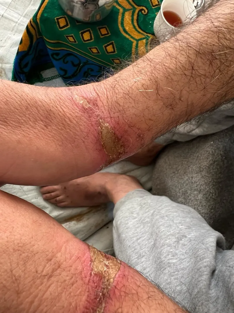 soykirimci-israil-vahsete-doymuyor-el-emel-hastanesinde-alikoydugu-2-doktora-uyguladigi-iskencenin-fotograflar-1708186237469.jpeg Soykırımcı İsrail vahşete doymuyor! El-Emel Hastanesinde alıkoyduğu 2 doktora uyguladığı işkencenin fotoğrafları ortaya çıktı-3