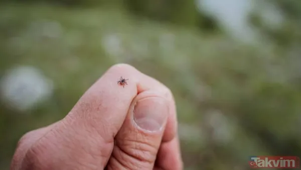 Keneler İnsan Vücudunun Herhangi Bir Yerine Tutunabilir, Ancak Kasık, Koltukaltı Ve Saçlı Deri Gibi Zor Görülen Bölgelerde Daha Sık Bulunurlar. Lyme Hastalığı...
