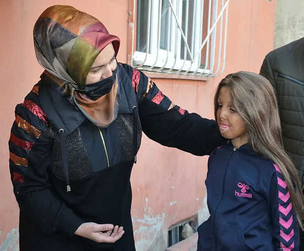 batmanda-250-yetim-cocuk-hediyelerle-sevindirildi-en-guzel-hediyemizi-vucudu-yanmis-olan-bir-kiz-kardesimize-verdik-1613315366939.jpg Batman'da 250 yetim çocuk hediyelerle sevindirildi: En güzel hediyemizi vücudu yanmış olan bir kız kardeşimize verdik-1