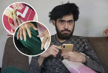 Her şey depremden sonra başladı! Ne dışarı çıkıyor ne yıkanıyor! Telefon bağımlısı Barış Özbay şaşkına çevirdi