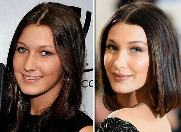 Online toplantılar hayatımıza girdi: Ekranda kendilerini beğenmeyenler estetik merkezine akın etti-3