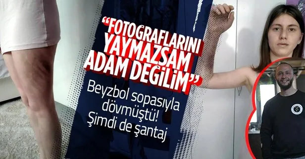 Sevgilisi Zeynep’i beyzbol sopasıyla dövmüştü! Şantaj suçundan bir dava daha: Fotoğraflarını her yere yayarım