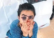 Melek İpekin öldürdüğü Ramazan İpek başka bir kadını da darp etmiş