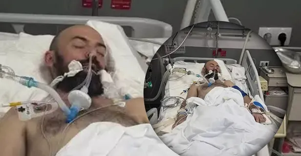 Adam grubunun vokalisti Mykhailo Klymenko’nun yaşam savaşı: Komaya girdi!