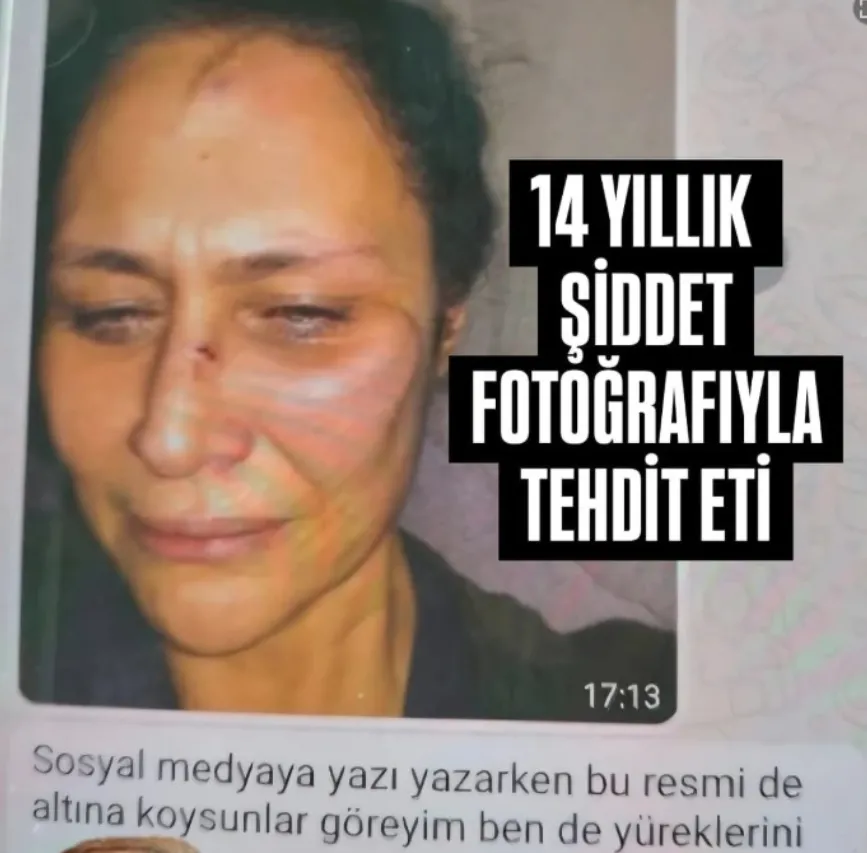İnanır ailesinde miras kavgası şiddet ifşasına dönüştü! Neslihan Acar'dan Levent İnanır hakkında şok iddia: "77 yaşındaki anneme yolladılar"-3