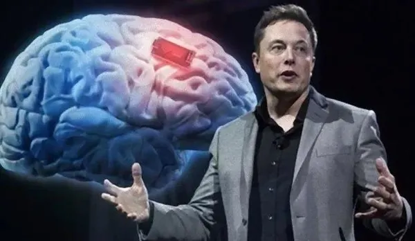 Elon Musk insanlara çip takacak: Neuralink çip tartışma konusu-3