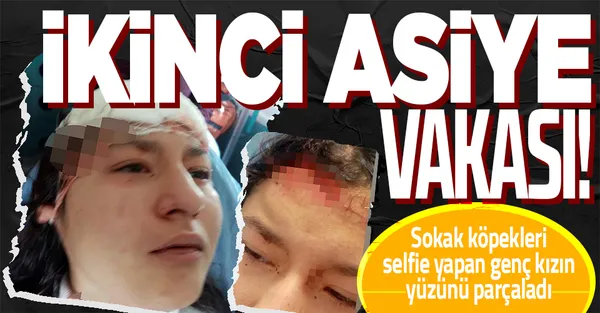2. Asiye Ateş vakası! Kastamonu'da sokak köpekleri selfie yapan genç kızın yüzünü parçaladı-1