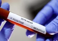 Türkiyede 22 Nisan koronavirüs vaka sayısı kaç oldu? Bakan Koca: Düne göre hasta sayısı düştü