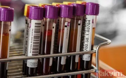 Bilim insanları uyarıyor! Kan grubunuza göre besinleri tüketin... Hangi kan grubu ne yemeli?