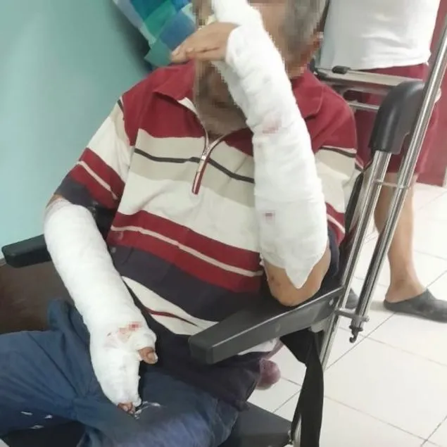 Sokak köpekleri kollarını parçaladı