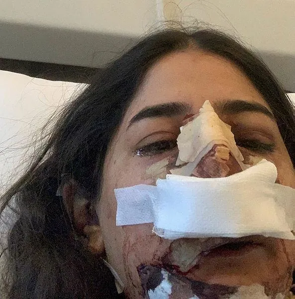 Son dakika: Ünlü estetisyen Op. Dr. Bilgehan Aydın'dan skandal olay! Burun operasyonu için kulağını kesti: Psikolojisi bozuldu-6