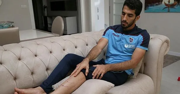 Trabzonsporlu Amiri’nin ayağı Adriano bastıktan sonra iki yerden delinmiş!