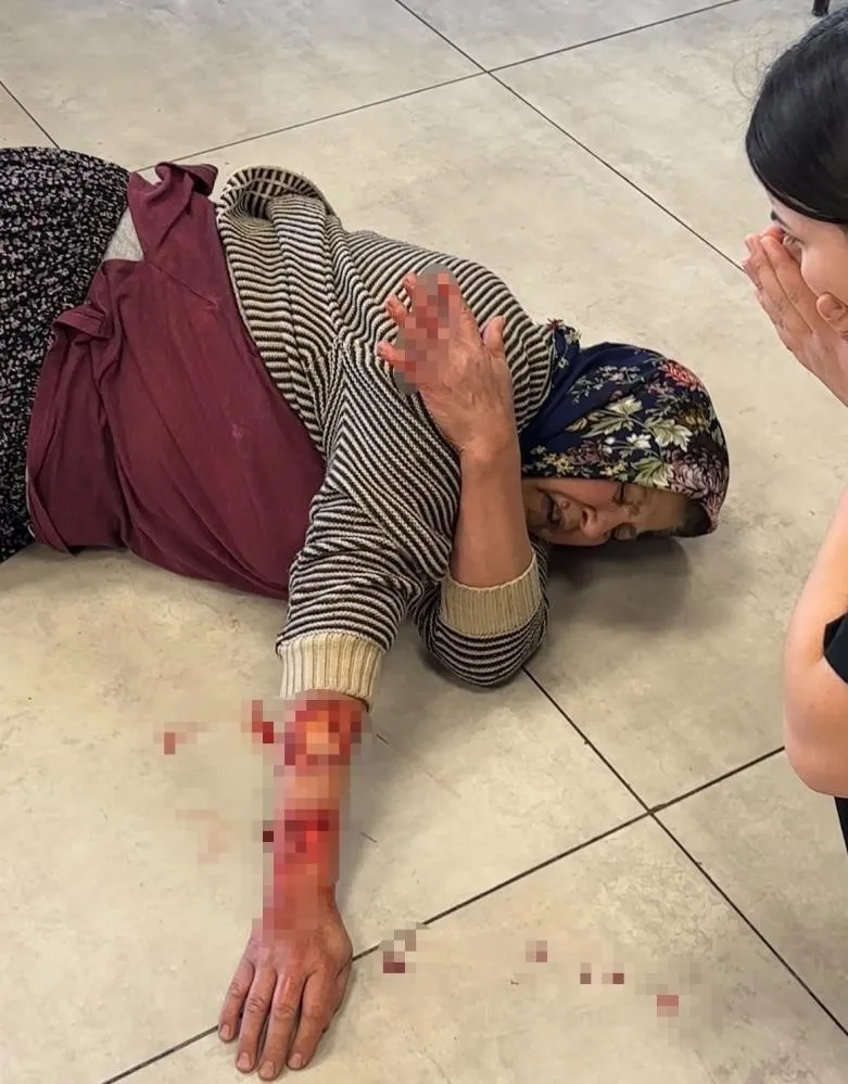 1781440674170.jpeg Afyonkarahisar'da can pazarı! Başıboş köpek kadının kolunu kopardı-5