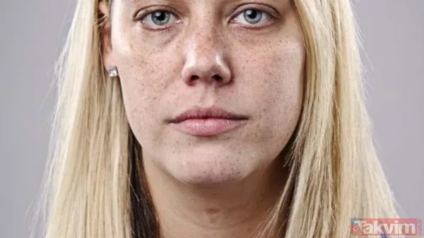 Bu belirtiler sizde de varsa dikkat! Yüzünüz hangi vitamin eksikliğiniz olduğunu söylüyor! - 7
